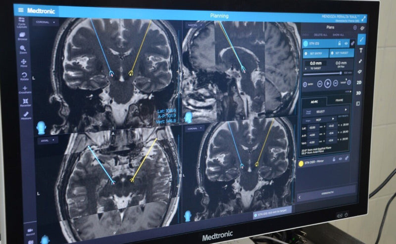 Reportaje TV Azteca Nuevo Tratamiento Natural para tratar Parkinson, Epilepsias y Convulsiones - Family Cbd Mexico